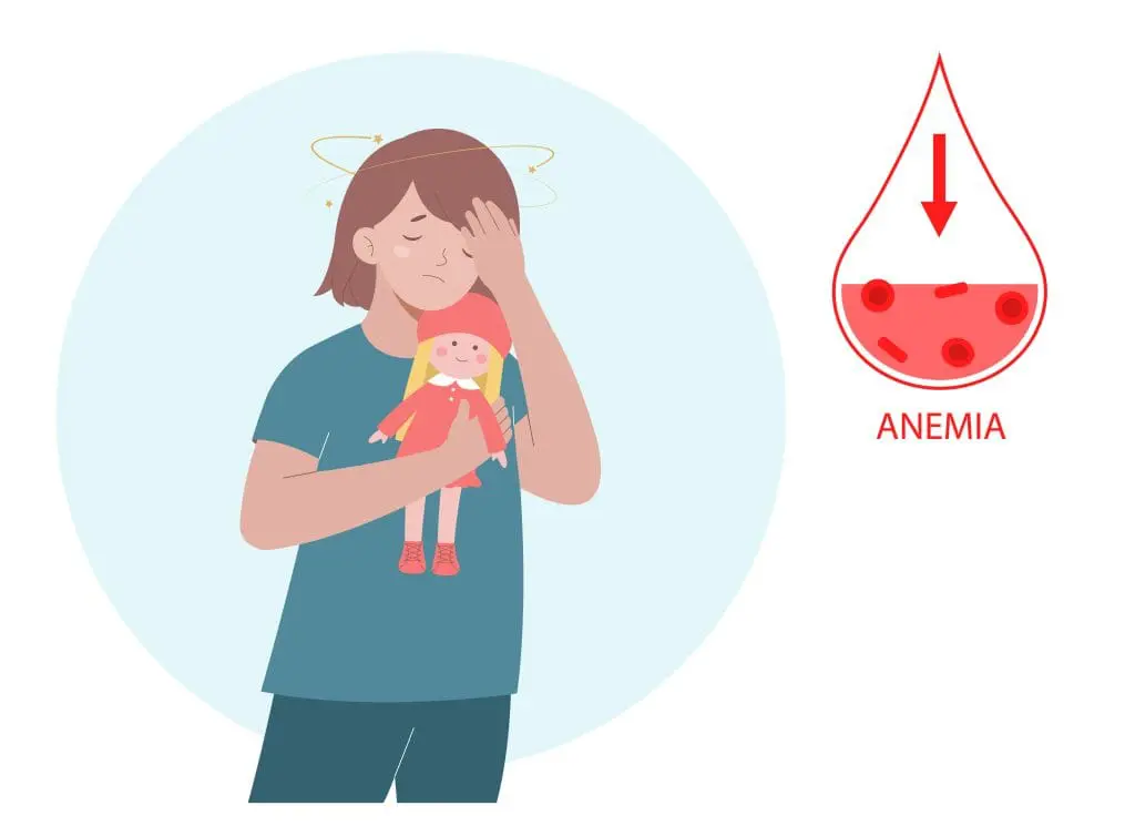 anemia