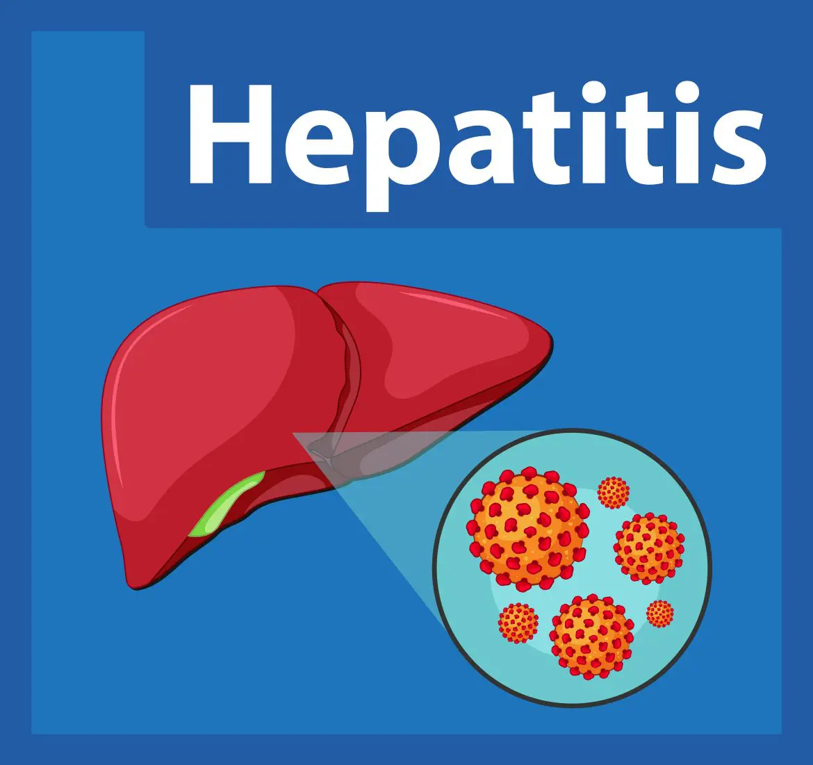 Autoimmune hepatitis